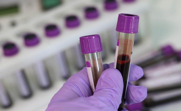 Maasstad Ziekenhuis test bloedmonsters voor politie