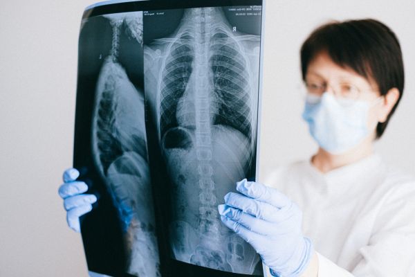 Vrouw houdt röntgefoto van logen vast