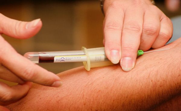 Afweercellen herinneren zich een hoog cholesterolgehalte