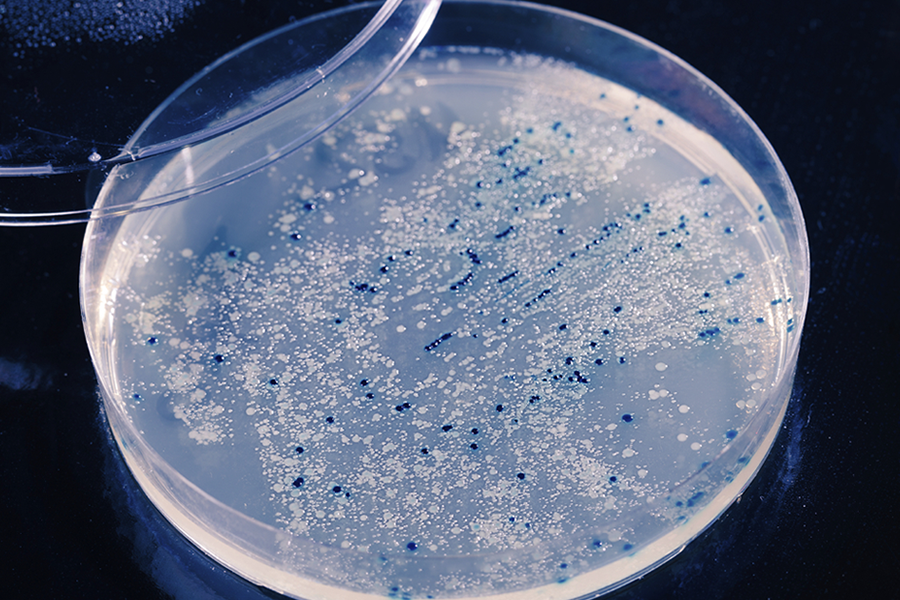Winnen we de oorlog tegen resistente bacteriën?