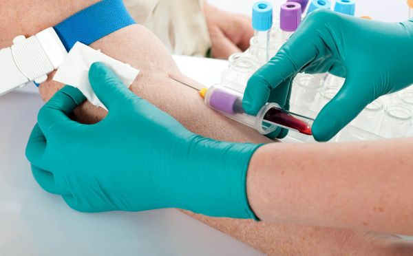 Binnen een jaar bloedtest alzheimer beschikbaar