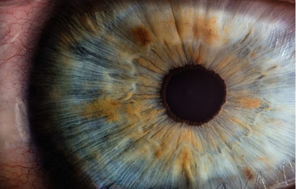 iris oog