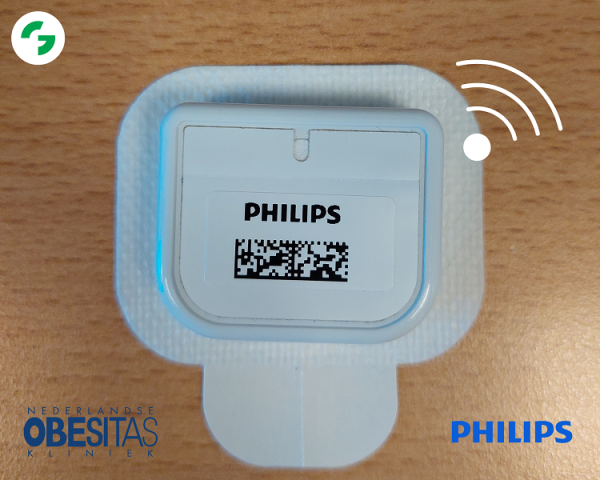 maagverkleining sensor