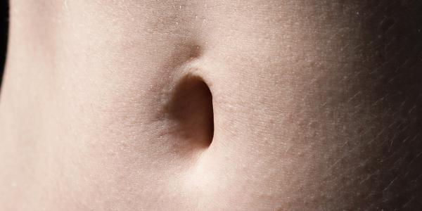 Onderzoek Erasmus MC: ‘Matjes beter bij kleine navelbreuken dan hechten’