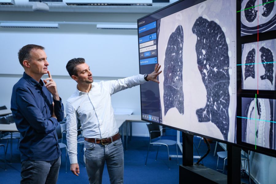 AI helpt bij longkankerscreening: veertig procent minder vals-positieve uitslagen