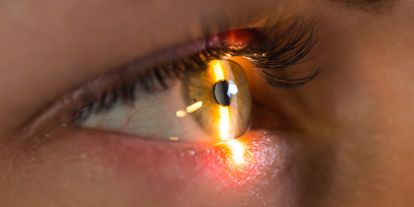 Laat van 12 t/m 17 maart gratis uw ogen op glaucoom controleren