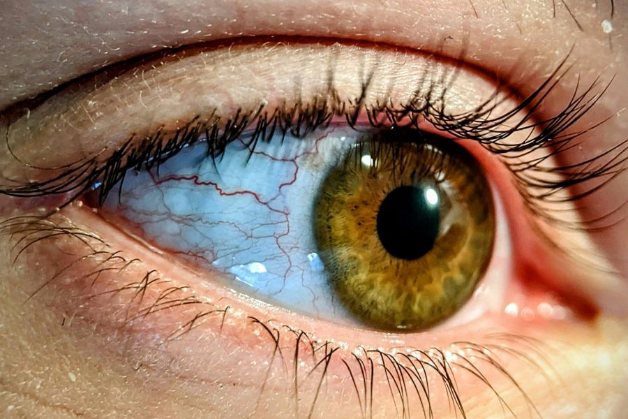 Oogkliniek Zeeland opent haar deuren