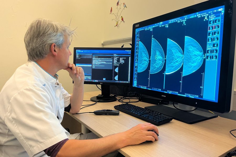 AI beoordeelt ook Nederlandse mammografie beter dan radioloog