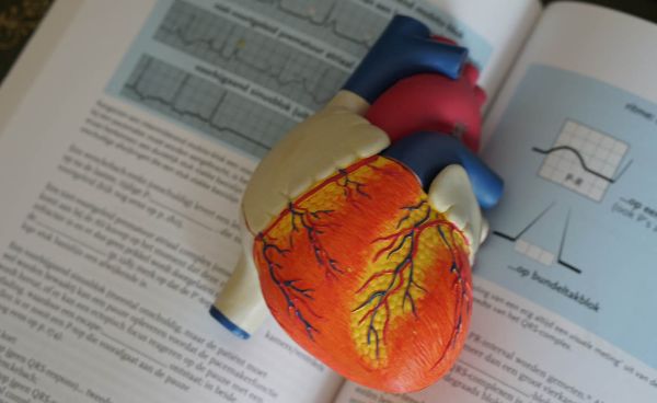 Uitgekiend verbeterprogramma zorgt voor betere overleving hartpatiënten