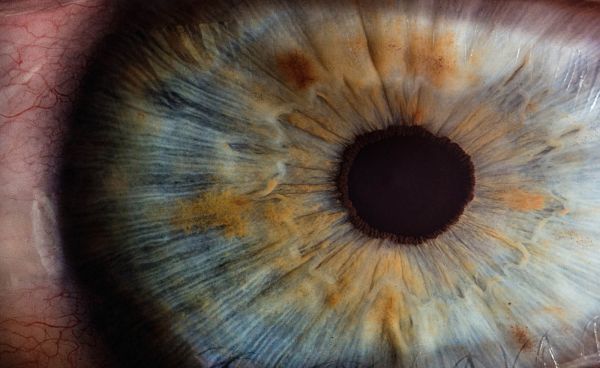 28 miljoen euro voor Luiks oogimplantaat