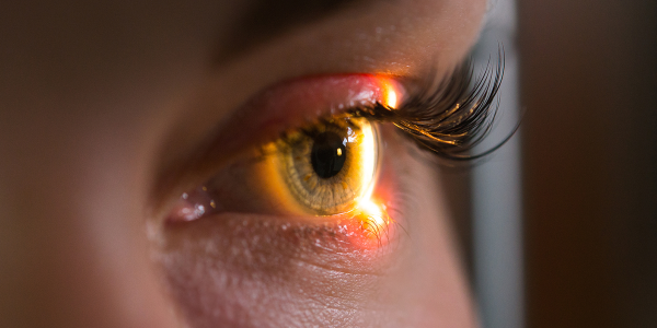 UZ Leuven ontwikkelt nieuwe software voor opsporing glaucoom